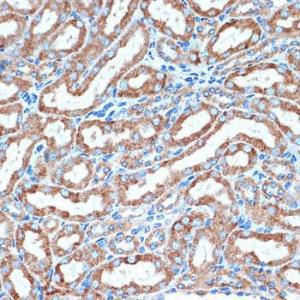 Immunohistochemistry analysis of paraffin-embedded mouse kidney using Anti-DcR2 Antibody [ARC2052] (A308265) at a dilution of 1:100 (40x lens). Perform microwave antigen retrieval with 10 mM Tris/EDTA buffer pH 9.0 before commencing with IHC staining protocol.