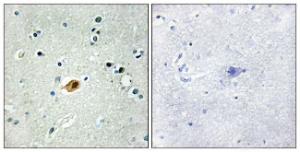 Anti-SOX8 and SOX9 and SOX17 and SOX18 antibody