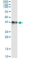 Anti-RAD51 Antibody Pair