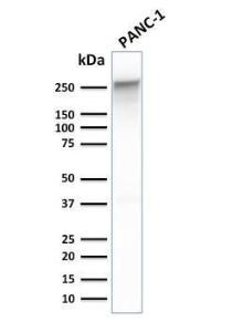 Anti-beta III Spectrin antibody