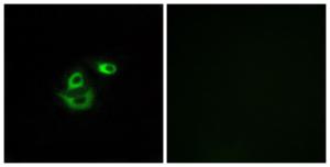 Immunofluorescence analysis of A549 cells using Anti-CLCC1 Antibody. The right hand panel represents a negative control, where the antibody was pre-incubated with the immunising peptide