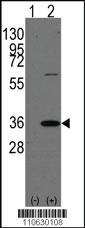 Anti-GYPB Rabbit Polyclonal Antibody