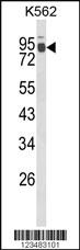 Anti-IRAK1 Rabbit Polyclonal Antibody