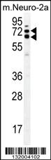 Anti-KLC2 Rabbit Polyclonal Antibody