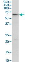 Anti-ALDH4A1 Rabbit Polyclonal Antibody