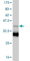 Anti-TBX18 Mouse Monoclonal Antibody [clone: 4D3]