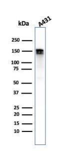 Anti-EGFR Rabbit Recombinant Antibody [clone: GFR/2968R]