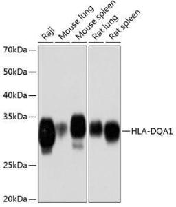 Western blot analysis of extracts of various cell lines, using Anti-HLA-DQA1 Antibody [ARC0564] (A305719) at 1:1,000 dilution. The secondary antibody was Goat Anti-Rabbit IgG H&L Antibody (HRP) at 1:10,000 dilution.