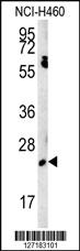 Anti-EBPL Rabbit Polyclonal Antibody