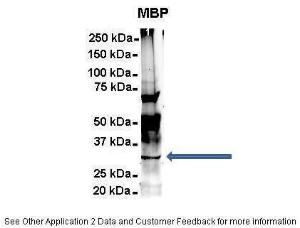 Anti-MBP Rabbit Polyclonal Antibody