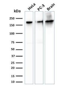 Anti-beta III Spectrin antibody