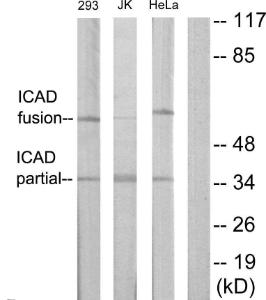 Western blot analysis of lysates from Jurkat, 293, and HeLa cells using Anti-DFFA Antibody. The right hand lane represents a negative control, where the antibody is blocked by the immunising peptide