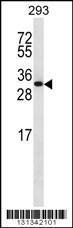 Anti-CHMP6 Rabbit Polyclonal Antibody