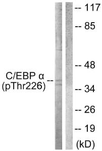 Western blot analysis of lysates from COS7 cells treated with EGF 200ng/ml 30' using Anti-CEBP alpha (phospho Thr226) Antibody The right hand lane represents a negative control, where the antibody is blocked by the immunising peptide