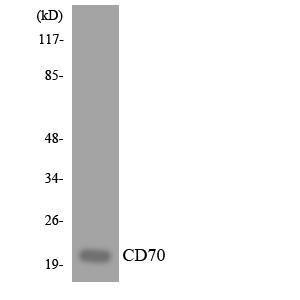 Western blot analysis of the lysates from Jurkat cells using Anti-CD70 Antibody