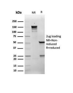 SDS-PAGE analysis of Anti-p21 Antibody [rCIP1/6907] under non-reduced and reduced conditions; showing intact IgG and intact heavy and light chains, respectively. SDS-PAGE analysis confirms the integrity and purity of the antibody.