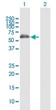 Anti-ALDH4A1 Rabbit Polyclonal Antibody