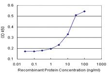 Anti-MYL6B Polyclonal Antibody Pair