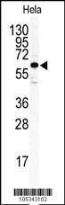 Anti-ILK Rabbit Polyclonal Antibody (HRP (Horseradish Peroxidase))