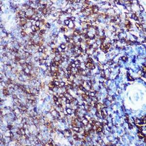 Immunohistochemistry analysis of paraffin-embedded rat spleen using Anti-HLA-DQA1 Antibody [ARC0564] (A305719) at a dilution of 1:100 (40x lens). Perform microwave antigen retrieval with 10 mM PBS buffer pH 7.2 before commencing with IHC staining protocol.