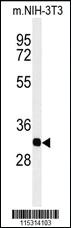 Anti-PYGB Rabbit Polyclonal Antibody