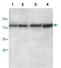 Anti-AGPS Rabbit Polyclonal Antibody