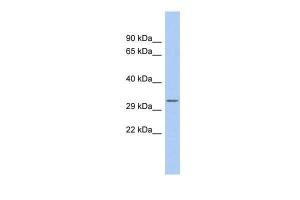 Anti-MBP Rabbit Polyclonal Antibody