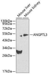 Western blot analysis of extracts of various cell lines, using Anti-ANGPTL3 Antibody (A12682) at 1:1,000 dilution. The secondary antibody was Goat Anti-Rabbit IgG H&L Antibody (HRP) at 1:10,000 dilution.