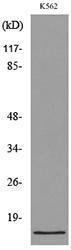 Western blot analysis of lysate from K562 cells using Anti-CD59 Antibody