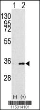 Anti-PYGB Rabbit Polyclonal Antibody