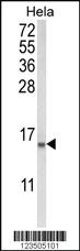 Anti-COTL1 Rabbit Polyclonal Antibody