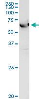 Anti-ALDH4A1 Rabbit Polyclonal Antibody