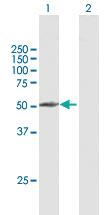 Anti-PPP2R3C Mouse Polyclonal Antibody