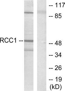 Western blot analysis of lysates from HepG2 cells using Anti-Retinoic Acid Receptor beta Antibody The right hand lane represents a negative control, where the antibody is blocked by the immunising peptide