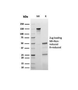 SDS-PAGE analysis of Anti-p27 Kip1 Antibody [rKIP1/1356] under non-reduced and reduced conditions; showing intact IgG and intact heavy and light chains, respectively. SDS-PAGE analysis confirms the integrity and purity of the antibody