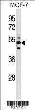 Anti-CHN1 Rabbit Polyclonal Antibody (AP (Alkaline Phosphatase))