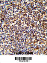 Anti-MAP2K3 Rabbit Polyclonal Antibody