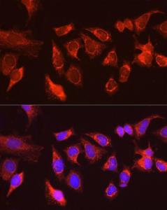 Immunofluorescence analysis of HeLa cells using Anti-KIAA0652 / ATG13 Antibody (A12683) at a dilution of 1:100 (40x lens). DAPI was used to stain the cell nuclei (blue)