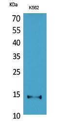 Western blot analysis of K562 cells using Anti-CD59 Antibody