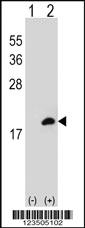 Anti-MAP2K3 Rabbit Polyclonal Antibody