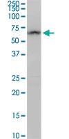 Anti-ALDH4A1 Rabbit Polyclonal Antibody