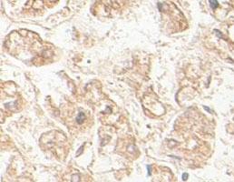 Anti-AGPS Rabbit Polyclonal Antibody