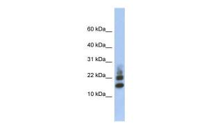 Anti-RPS15A Rabbit Polyclonal Antibody