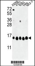 Anti-MAP3K5 Rabbit Polyclonal Antibody