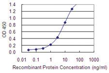 Anti-EML2 Mouse Monoclonal Antibody [clone: 2H6]