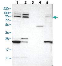 Anti-TRAK2 Rabbit Polyclonal Antibody