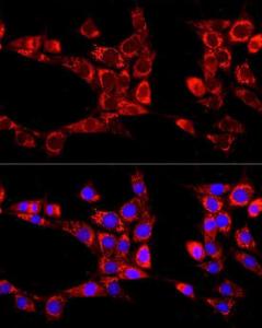 Immunofluorescence analysis of NIH/3T3 cells using Anti-KIAA0652 / ATG13 Antibody (A12683) at a dilution of 1:100 (40x lens). DAPI was used to stain the cell nuclei (blue)