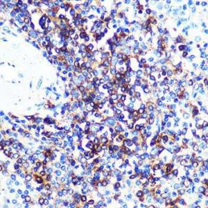 Immunohistochemistry analysis of paraffin-embedded human spleen using Anti-HLA-DQA1 Antibody [ARC0564] (A305719) at a dilution of 1:100 (40x lens). Perform microwave antigen retrieval with 10 mM PBS buffer pH 7.2 before commencing with IHC staining protocol.