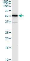 Anti-ALDH4A1 Mouse Monoclonal Antibody [clone: 1A12-A5]