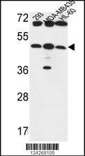 Anti-B3GNT5 Rabbit Polyclonal Antibody (PE (Phycoerythrin))